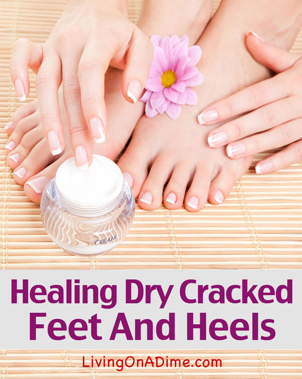 salicylic acid for cracked heels