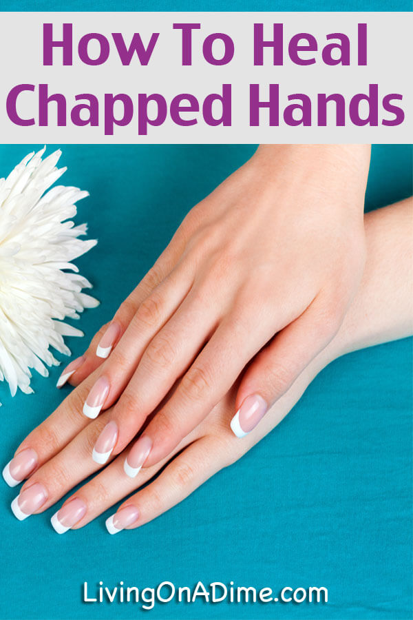 How To Heal Chapped Hands Natural Recipe For Winter Dry Skin Living On A Dime To Grow Rich