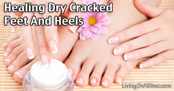 Review: Dr. Scholl's Cracked Heel Repair Balm - The Solution for Dry  Cracked Feet! - YouTube